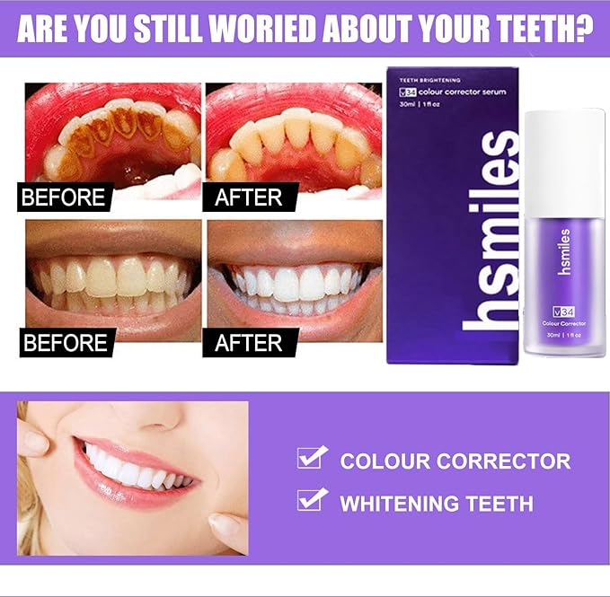 π¦·β¨ Hismile V34 Colour Corrector β Brighten Your Smile Instantly! ππ«