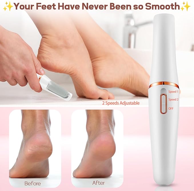 Foot Grinding Machine, Electric Dead Skin Grinding Foot Sharpening Machine, Sandpaper Care Tool, Skin corrector Cleaning Tools, Foot Callus Remover 2 GET 1 FREE - DoorAndSteps E Commerce