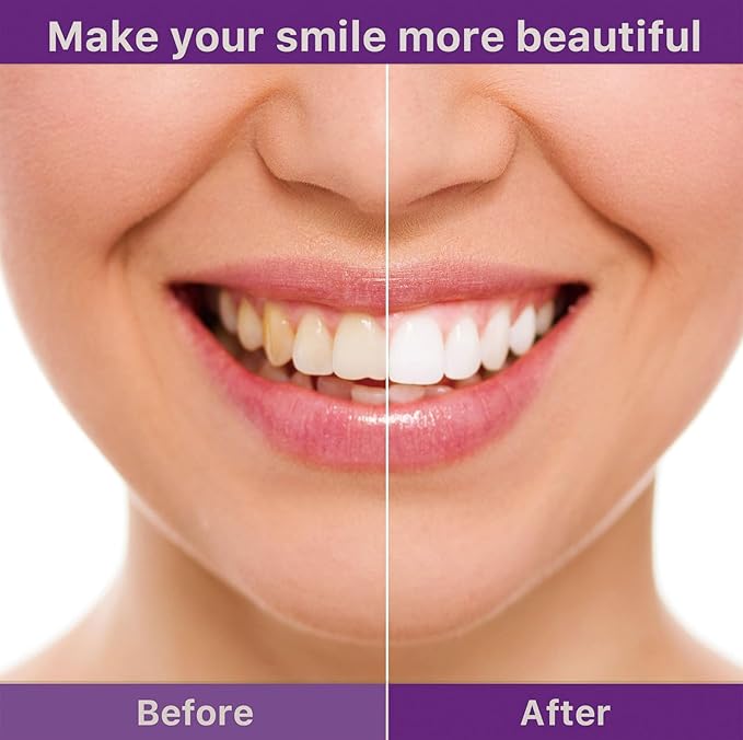 π¦·β¨ Hismile V34 Colour Corrector β Brighten Your Smile Instantly! ππ«