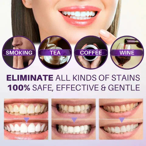 π¦·β¨ Hismile V34 Colour Corrector β Brighten Your Smile Instantly! ππ«