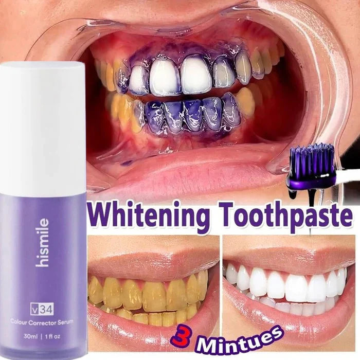 π¦·β¨ Hismile V34 Colour Corrector β Brighten Your Smile Instantly! ππ«