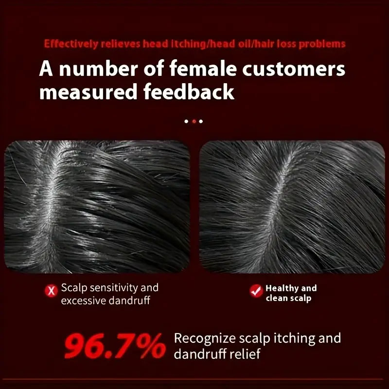 Electric Scalp Massage Comb | Relaxation Meets Beauty in Style - DoorAndSteps E Commerce