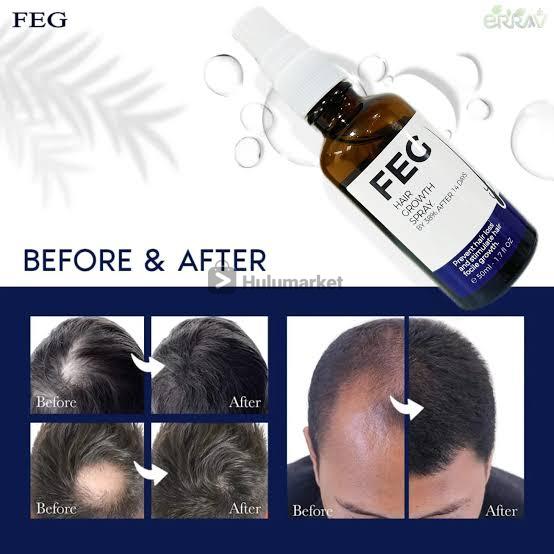 π FEG Hair Growth Spray β Boost Hair Growth by 38% in Just 14 Days! π - DoorAndSteps E Commerce