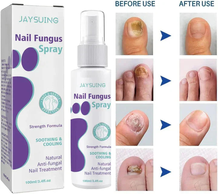 🦶 Medinail Advanced Antifungal Foot & Nail Spray – Soothing & Cooling Treatment for Athlete’s Foot, Nail Fungus, and Odor Control – 100ml - DoorAndSteps E Commerce 